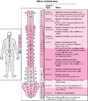 diseases in the body that involve damage to different parts of the spine