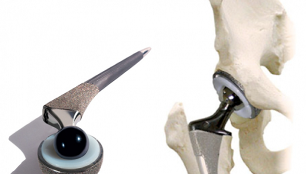 Medicine of the hip joints for the treatment of joint diseases