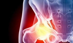 the cause of the development of hip joint disease