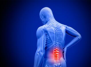 Lumbar back pain