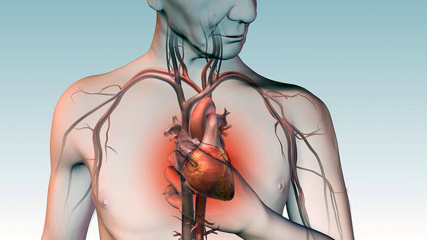 Pain below the collarbone and pressure behind the sternum due to heart disease