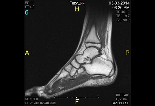 ankle image for dry joints
