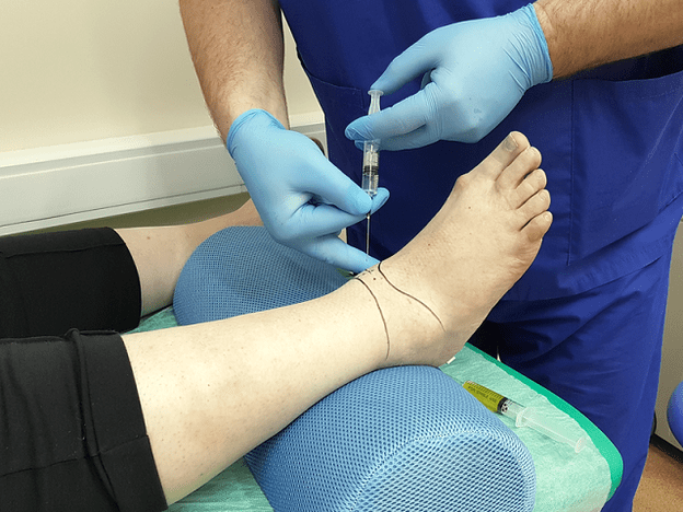 ankle joint puncture