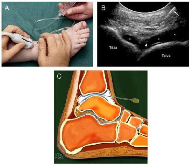 ankle joint ultrasound with joints