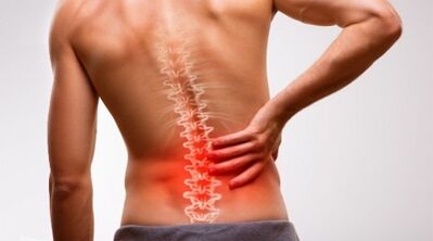 Signs and symptoms of the spine osteoarthritis
