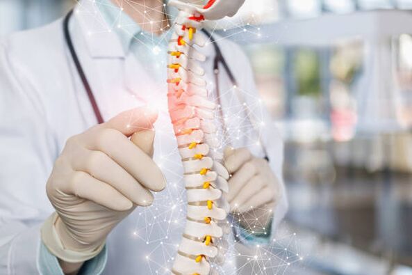 Spondylosis is a spinal disease