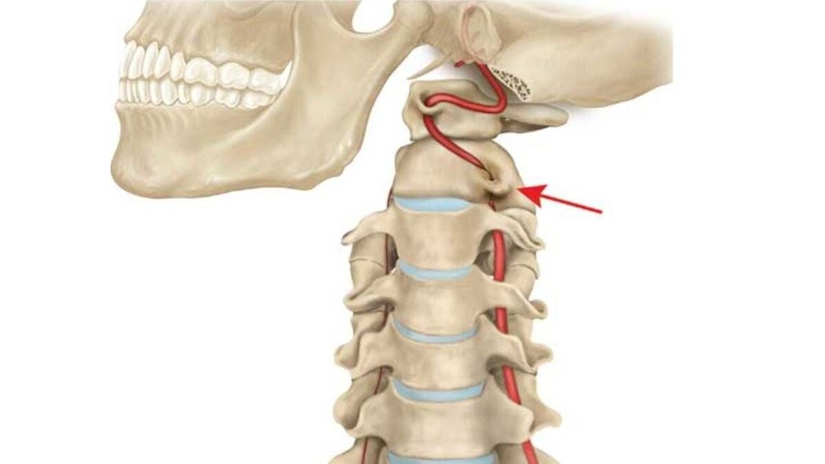 cervical spine degeneration