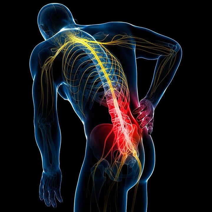 causes of back pain